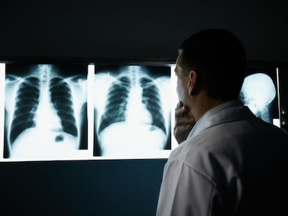 Male doctor at work in public medical clinic and examining x-ray plates of bones, skull and lungs