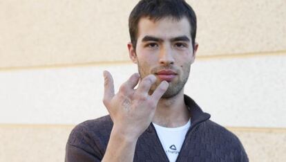 Pablo Morganti muestra la mano en la que sufrió la amputación de un dedo al quedar atrapada en una trituradora de carne.