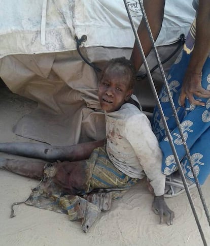 Un niño herido tras el ataque militar a un campamento para personas desplazadas en Rann (Nigeria).
