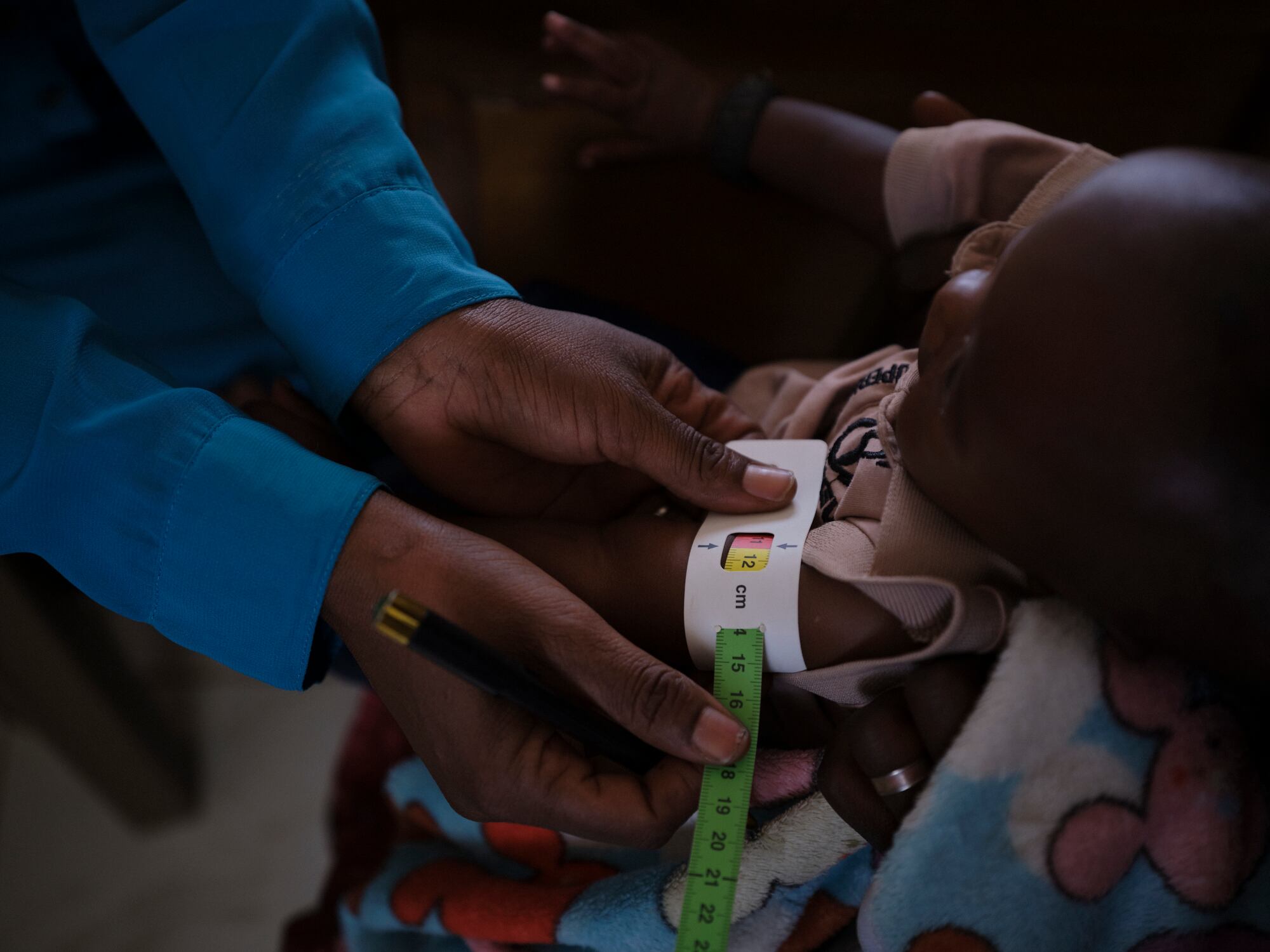 Una trabajadora de Almanar realiza en una clínica de Jebel Awlia la medición de la circunferencia media del brazo con la cinta MUAC (del inglés Mid-Upper Arm Circumference o Circunferencia del Brazo en su Punto Medio) a una niña con desnutrición aguda severa.