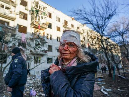Una herida tras el ataque a un bloque de viviendas en la ciudad ucrania de Chuhuiv. 