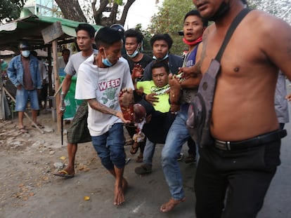 Um ferido nos protestos recebe atendimento médico na cidade de Dawei, no sul de Mianmar.