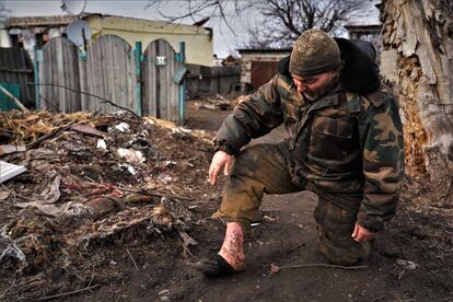 Volodímir, de 51 años, muestra ante su casa en Petropavlivka la herida sin curar de su pie derecho desde que fue alcanzado en septiembre por metralla.