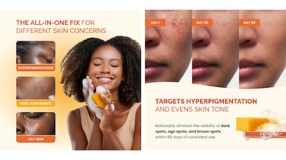 This turmeric soap is perfect for blemished skin.