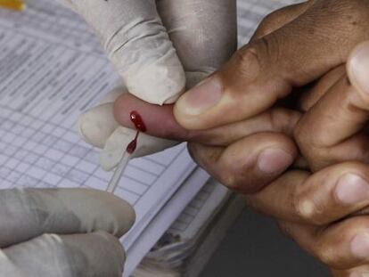 Un hombre en Johannesburgo (Sudáfrica) se somete a una prueba rápida para detectar el VIH.