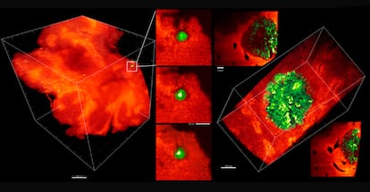 Hígado de ratón con micrometástasis (izquierda) y metástasis de mayor tamaño.