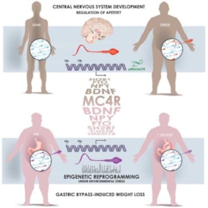 El gráfico muestra cómo el espematozoide de un hombre obeso tiene unas marcas 'epigenéticas' distintas a la de uno delgado, tras someterse a un 'baypass' gástrico, especialmente en los genes que controlan el desarrollo y la función del cerebro