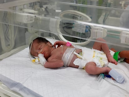 Alma, la bebé gazatí que nació huérfana por un ataque israelí, en una incubadora en un hospital de Rafah.