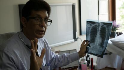 El médico indio Zarir Udwadia fue uno de los primeros en alertar al país de la tuberculosis multirresistente.