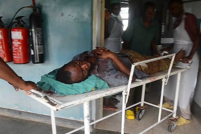 Un herido en el ataque al instituto, este sábado en una clínica de la localidad de Mpondwe.