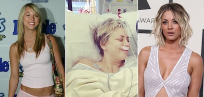 En diciembre de 2015, la actriz Kaley Cuoco publicaba en su Instagram los momentos previos a someterse a una operación de nariz por sus problemas para respirar. Unos meses antes, la actriz confirmaba que a los 18 años se había sometido a una operación de pechos. "La mejor decisión que he tomado nunca", contaba una de las protagonistas de 'Big Bang Theory' a la revista 'Cosmopolitan'.