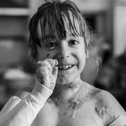 La imagen 'Toda una vida', del fotógrafo Martín Corradini, retrata la sonrisa de Victoria, paciente con "piel de mariposa", en el proyecto 'La mirada del paciente', de Cinfa.