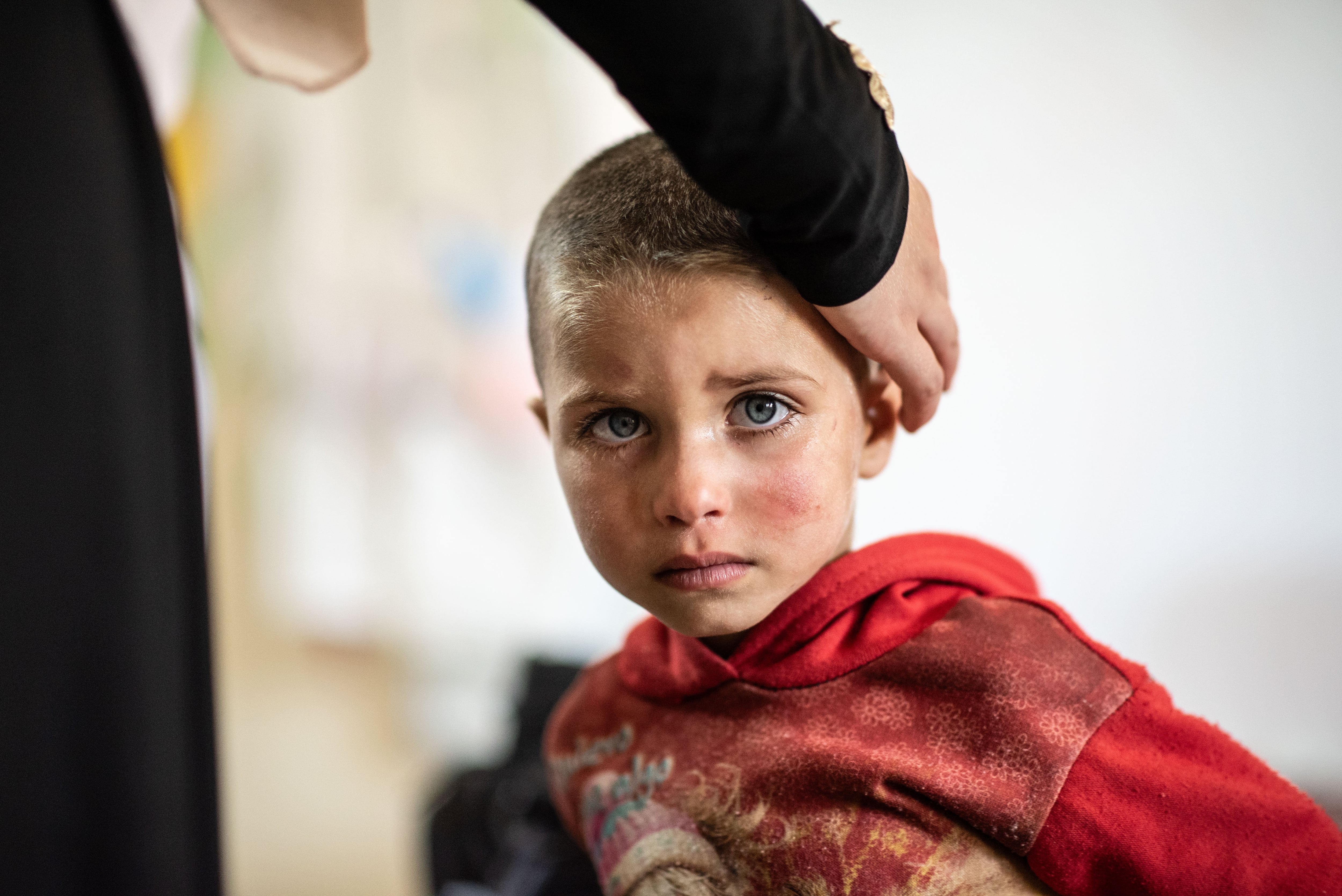 Duaa Shahadeh, en el centro de salud Arman de Homs, donde su hermano menor Malak recibe tratamiento tras sufrir desnutrición aguda, el pasado 27 de julio.