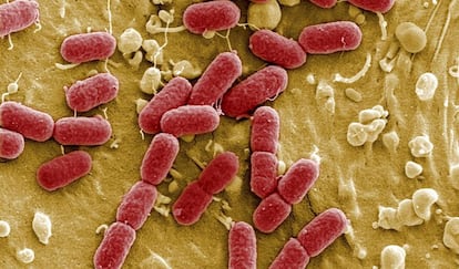 Bacterias 'Escherichia coli' vistas en el microscopio electrónico. 