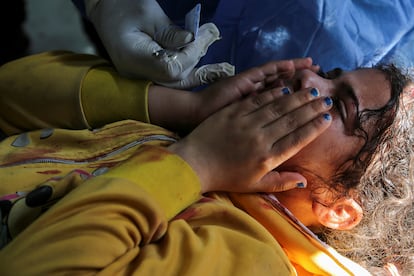 Una niña palestina herida en Rafah por un ataque aéreo del ejército israelí.