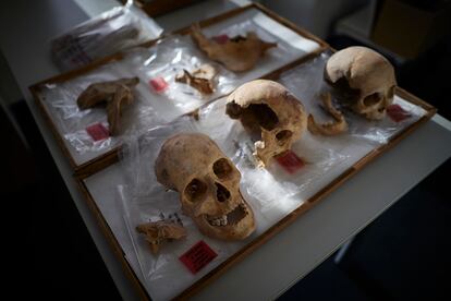 Tres de los restos óseos atribuidos o relacionados con Cristóbal Colón, en la Facultad de Medicina de Granada.
