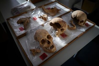 Tres de los restos óseos atribuidos o relacionados con Cristóbal Colón, en la Facultad de Medicina de Granada. 