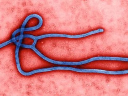 The ebola virus.