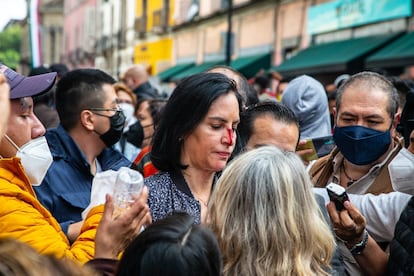 La alcaldesa electa de Álvaro Obregón, Lía Limón, muestra su lesión en la nariz frente al Congreso.