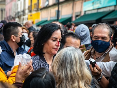 La alcaldesa electa de Álvaro Obregón, Lía Limón, muestra su lesión en la nariz frente al Congreso.