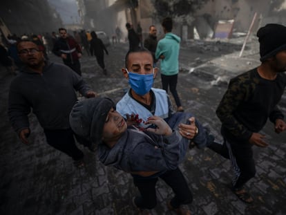 Rafah (---), 20/11/2023.- An injured child is assisted following Israeli air strikes in Rafah town in the southern Gaza Strip, 20 November 2023. More than 13,000 Palestinians and at least 1,400 Israelis have been killed, according to the Israel Defense Forces (IDF) and the Palestinian health authority, since Hamas militants launched an attack against Israel from the Gaza Strip on 07 October, and the Israeli operations in Gaza and the West Bank which followed it. EFE/EPA/MOHAMMED SABER
