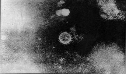 Imagen del virus de la hepatitis C.