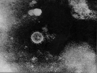 Imagen del virus de la hepatitis C.