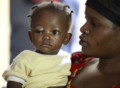 Una beb&eacute; que sobrevivi&oacute; al atentado del lunes en Abuya con su madre. 