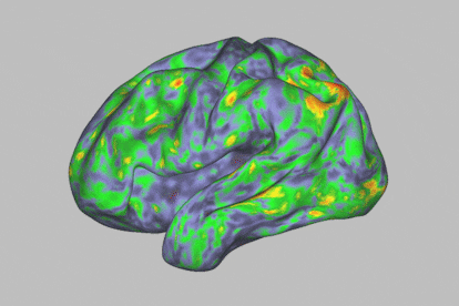 Mapa de calor de los patrones de actividad cerebral que muestra una profunda alteración durante la experiencia de un individuo después de tomar psilocibina.