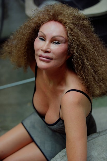 Socialite Jocelyn Wildenstein is one of the women who has taken cosmetic surgery to the extreme to the extent that it played a role in her divorce.