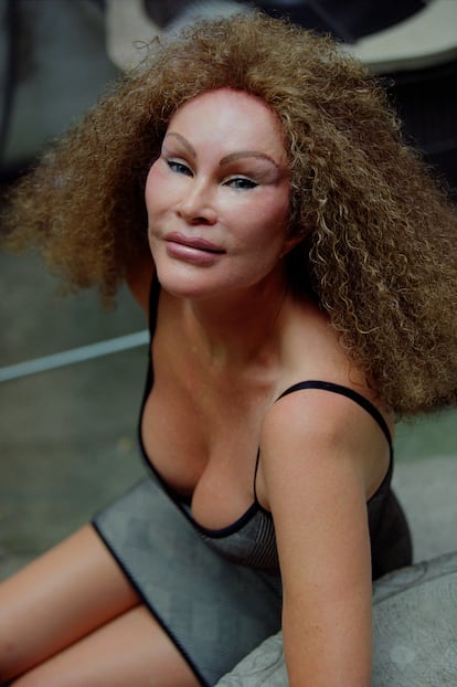 Jocelyn Wildenstein es una de las mujeres que ha llevado al extremo la cirugía estética. Sus numerosas operaciones influyeron en su divorcio.