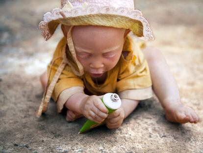 Imagen de Ana Palacios, de la fotogalería Una casa para los albinos de Planeta Futuro