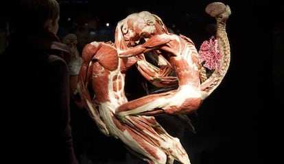 Muestra de la exposici&oacute;n &#039;Human Bodies&#039;. 