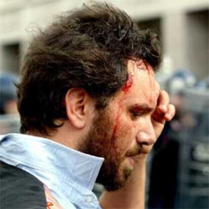 Un manifestante herido en la cabeza tras los enfrentamientos con la policía.