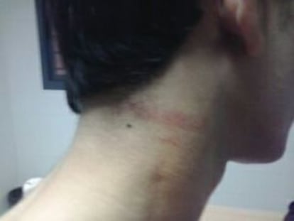Mohamed Noureddine muestra las marcas de supuestas agresiones.