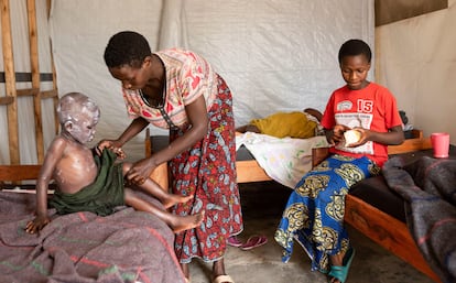 Una mujer aplicaba el domingo una medicina sobre la piel de un niño con mpox, en Munigi (República Democrática del Congo).