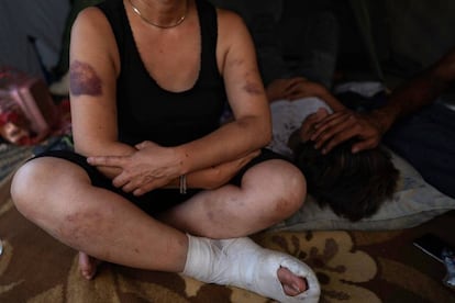 Día a día, los refugiados se enfrentan a la brutalidad policiaca en esta frontera balcánica. No interesa si eres niña, mujer o anciano.