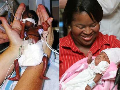 La pequeña Amillia Sonja Taylor en octubre, al poco de nacer, y el lunes pasado con su madre.