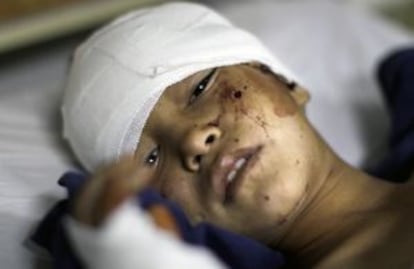 El niño afgano Ali Ahmad, de nueve años, resultó herido en el atentado.
