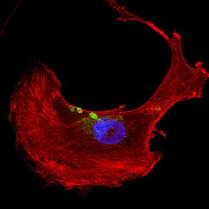 C&eacute;lulas cardiacas de rata en las que se ha comprobado el da&ntilde;o que genera la mutaci&oacute;n del gen &#039;FLNC&#039; que portaban los pacientes