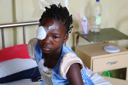 Las mujeres en Inhambane, enfrentan barreras sociales que les impide acceder a un adecuado servicio de salud ocular.