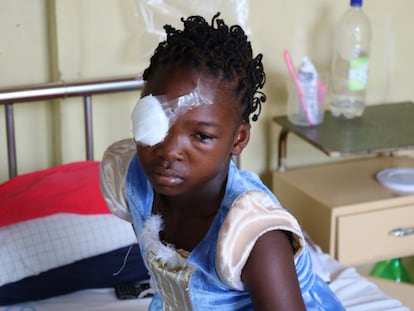 Las mujeres en Inhambane, enfrentan barreras sociales que les impide acceder a un adecuado servicio de salud ocular.