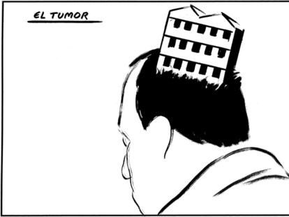 EL ROTO