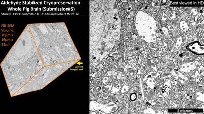 El cerebro de un cerdo, criopreservado