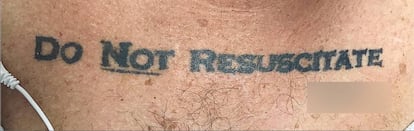 El tatuaje del paciente con su rúbrica tapada. Publicado por 'The New England Journal of Medicine'.