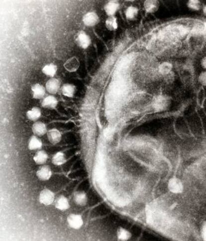 La mayor&iacute;a de los virus son bacteri&oacute;fagos. En la imagen, fagos adheridos a una bacteria.