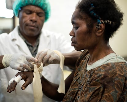 Una paciente recibe tratamiento en el Hospital en Tari, Papúa Nueva Guinea, después de que su marido la atacase con un machete.