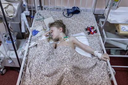 Dima, un niño de tres años que resultó herido durante los bombardeos de Mariupol (sudeste), yacía el martes en una cama de un hospital de Zaporiyia. El Gobierno de Rusia ha asegurado este miércoles haber destruido dos almacenes de armas del Ejército de Ucrania en Jmelnitski, en el oeste del país, en el marco de la ofensiva militar iniciada el 24 de febrero por orden del presidente ruso, Vladímir Putin.