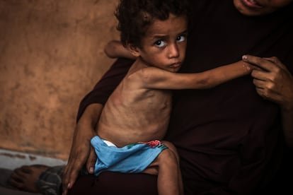 Yezen Abu Ful, niño desnutrido de dos años, en los brazos de su madre en el campo de refugiados de Al Shati el 24 de julio.