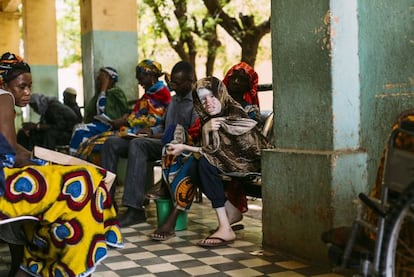 Rabiatou Traor&eacute;, de 15 a&ntilde;os, fotografiada el 26 de junio en el hospital de Bamako. Padece un c&aacute;ncer de piel en la cabeza. 